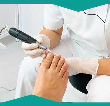 しっかり矯正で改善